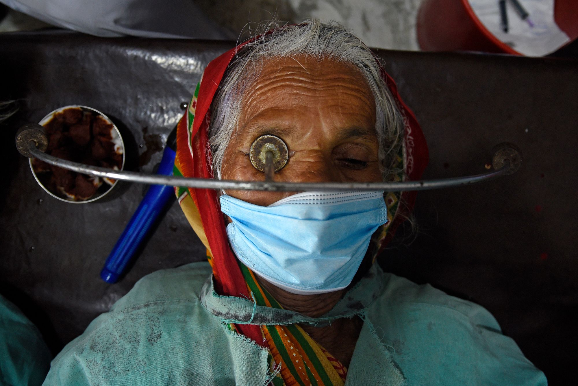 A close up photo of a female patient with cataracts in a hospital room prior to her surgery 