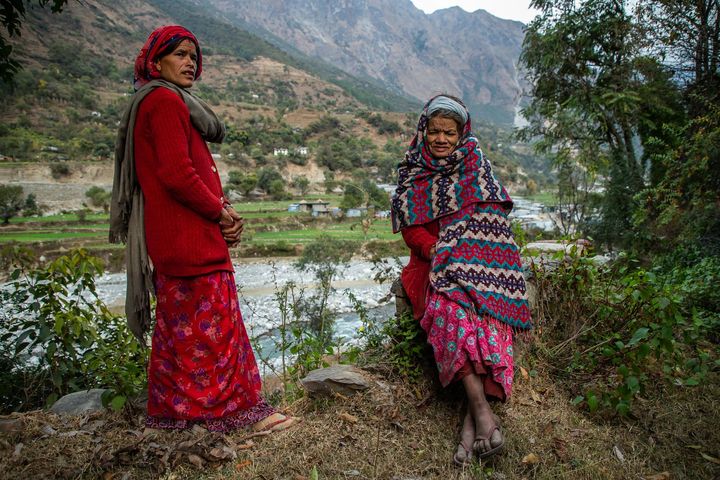Blindness In Women | Tej Kohli & Ruit Foundation